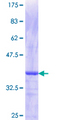 ZSCAN4 Protein - 12.5% SDS-PAGE Stained with Coomassie Blue.