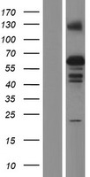 ZSCAN5B Protein - Western validation with an anti-DDK antibody * L: Control HEK293 lysate R: Over-expression lysate