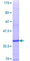 ZSWIM2 Protein - 12.5% SDS-PAGE Stained with Coomassie Blue.