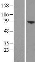 ZSWIM3 Protein - Western validation with an anti-DDK antibody * L: Control HEK293 lysate R: Over-expression lysate
