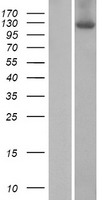 ZSWIM4 Protein - Western validation with an anti-DDK antibody * L: Control HEK293 lysate R: Over-expression lysate