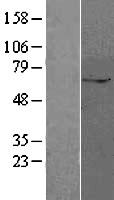 ZUFSP Protein - Western validation with an anti-DDK antibody * L: Control HEK293 lysate R: Over-expression lysate