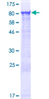 ZUFSP Protein - 12.5% SDS-PAGE of human C6orf113 stained with Coomassie Blue