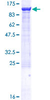 ZW10 Protein - 12.5% SDS-PAGE of human ZW10 stained with Coomassie Blue