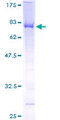 ZWILCH Protein - 12.5% SDS-PAGE of human FLJ10036 stained with Coomassie Blue
