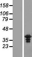 ZWINT Protein - Western validation with an anti-DDK antibody * L: Control HEK293 lysate R: Over-expression lysate