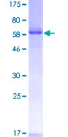 ZWINT Protein - 12.5% SDS-PAGE of human ZWINT stained with Coomassie Blue