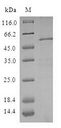 ZWINT Protein - (Tris-Glycine gel) Discontinuous SDS-PAGE (reduced) with 5% enrichment gel and 15% separation gel.