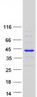 ZWINT Protein - Purified recombinant protein ZWINT was analyzed by SDS-PAGE gel and Coomassie Blue Staining