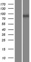 ZXDA Protein - Western validation with an anti-DDK antibody * L: Control HEK293 lysate R: Over-expression lysate