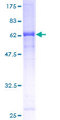 ZYG11B Protein - 12.5% SDS-PAGE of human ZYG11B stained with Coomassie Blue