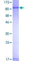 Zyxin Protein - 12.5% SDS-PAGE of human ZYX stained with Coomassie Blue