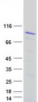 Zyxin Protein - Purified recombinant protein ZYX was analyzed by SDS-PAGE gel and Coomassie Blue Staining