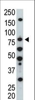 HUNK / B19 Antibody - The anti-HUNK antibody is used in Western blot to detect HUNK in NIH/3T3 cell lysate.