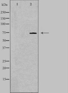 HUNK / B19 Antibody - Western blot analysis of extracts of HepG2 cells using HUNK antibody. The lane on the left is treated with the antigen-specific peptide.