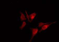 HUNK / B19 Antibody - Staining HeLa cells by IF/ICC. The samples were fixed with PFA and permeabilized in 0.1% Triton X-100, then blocked in 10% serum for 45 min at 25°C. The primary antibody was diluted at 1:200 and incubated with the sample for 1 hour at 37°C. An Alexa Fluor 594 conjugated goat anti-rabbit IgG (H+L) Ab, diluted at 1/600, was used as the secondary antibody.