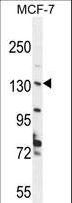 HUPF2 / UPF2 Antibody - UPF2 Antibody western blot of MCF-7 cell line lysates (35 ug/lane). The UPF2 antibody detected the UPF2 protein (arrow).