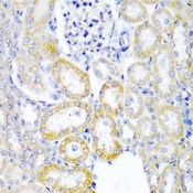 HUPF2 / UPF2 Antibody - Immunohistochemistry of paraffin-embedded rat kidney tissue.
