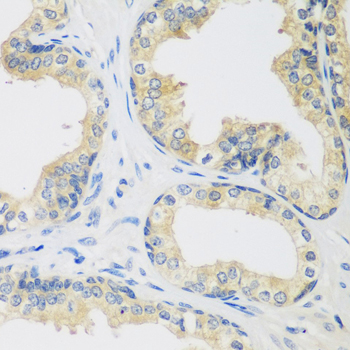HUPF2 / UPF2 Antibody - Immunohistochemistry of paraffin-embedded human prostate.