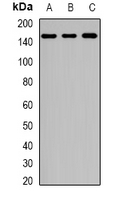 HUPF2 / UPF2 Antibody - Western blot analysis of Rent2 expression in Jurkat (A); HepG2 (B); HeLa (C) whole cell lysates.