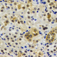 HUPF2 / UPF2 Antibody - Immunohistochemical analysis of Rent2 staining in rat kidney formalin fixed paraffin embedded tissue section. The section was pre-treated using heat mediated antigen retrieval with sodium citrate buffer (pH 6.0). The section was then incubated with the antibody at room temperature and detected using an HRP conjugated compact polymer system. DAB was used as the chromogen. The section was then counterstained with hematoxylin and mounted with DPX.