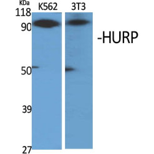 HURP / DLGAP5 Antibody - Western blot of HURP antibody