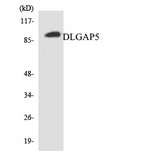HURP / DLGAP5 Antibody - Western blot analysis of the lysates from HT-29 cells using DLGAP5 antibody.