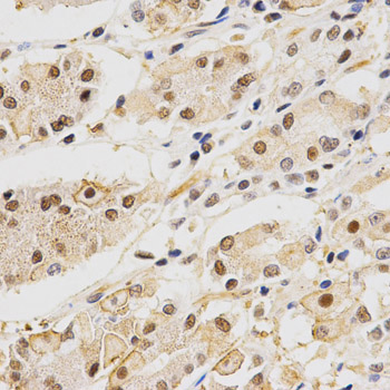 HURP / DLGAP5 Antibody - Immunohistochemistry of paraffin-embedded human stomach transfer tissue.