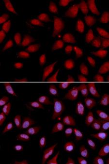 HURP / DLGAP5 Antibody - Immunofluorescence analysis of U2OS cells.