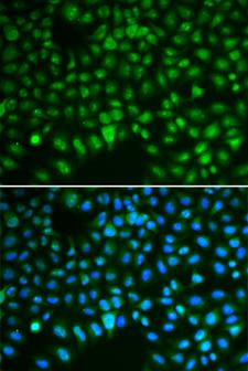 HURP / DLGAP5 Antibody - Immunofluorescence analysis of HeLa cells.