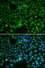 HURP / DLGAP5 Antibody - Immunofluorescence analysis of HeLa cells using DLGAP5 antibody. Blue: DAPI for nuclear staining.