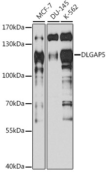 HURP / DLGAP5 Antibody - Western blot analysis of extracts of various cell lines, using DLGAP5 antibody at 1:1000 dilution. The secondary antibody used was an HRP Goat Anti-Mouse IgG (H+L) at 1:10000 dilution. Lysates were loaded 25ug per lane and 3% nonfat dry milk in TBST was used for blocking. An ECL Kit was used for detection and the exposure time was 90s.
