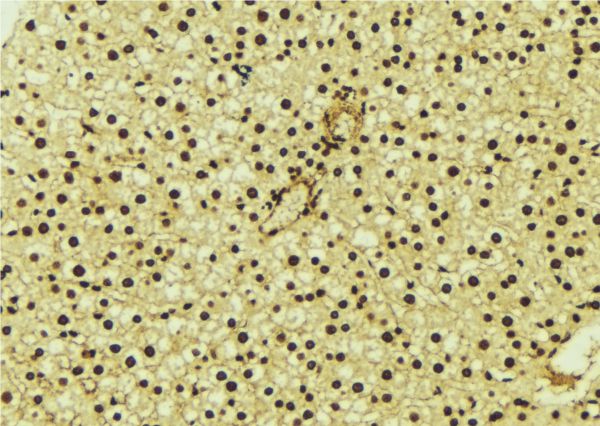 HURP / DLGAP5 Antibody - 1:100 staining mouse liver tissue by IHC-P. The sample was formaldehyde fixed and a heat mediated antigen retrieval step in citrate buffer was performed. The sample was then blocked and incubated with the antibody for 1.5 hours at 22°C. An HRP conjugated goat anti-rabbit antibody was used as the secondary.