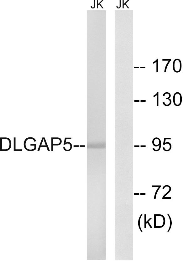 HURP / DLGAP5 Antibody - Western blot analysis of extracts from Jurkat cells, using DLGAP5 antibody.