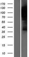 HURP / DLGAP5 Protein - Western validation with an anti-DDK antibody * L: Control HEK293 lysate R: Over-expression lysate