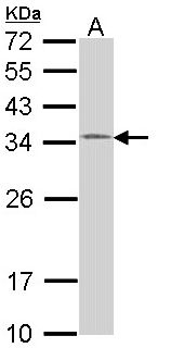 HUS1 Antibody - Sample (30 ug of whole cell lysate). A:293T. 12% SDS PAGE. HUS1 antibody diluted at 1:1000.