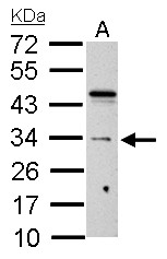 HUS1 Antibody - HUS1 antibody detects HUS1 protein by Western blot analysis. A. 30 ug C8D30 whole cell lysate/extract. 12 % SDS-PAGE. HUS1 antibody dilution:1:1000