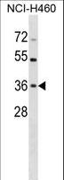 HUS1 Antibody - HUS1 Antibody western blot of NCI-H460 cell line lysates (35 ug/lane). The HUS1 antibody detected the HUS1 protein (arrow).
