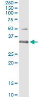 HUS1 Antibody - Immunoprecipitation of HUS1 transfected lysate using anti-HUS1 monoclonal antibody and Protein A Magnetic Bead, and immunoblotted with HUS1 rabbit polyclonal antibody.