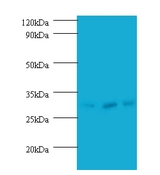 HUS1 Antibody - Western blot of Checkpoint protein HUS1 antibody at 2 ug/ml. lane 1: HeLa whole cell lysate. lane 2: 293T whole cell lysate. Lane 3: A431 whole cell lysate. Secondary: Goat polyclonal to Rabbit IgG at 1:10000 dilution. Predicted band size: .  This image was taken for the unconjugated form of this product. Other forms have not been tested.