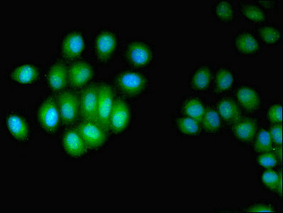 HUS1 Antibody - Immunofluorescent analysis of A549 cells using HUS1 Antibody at dilution of 1:100 and Alexa Fluor 488-congugated AffiniPure Goat Anti-Rabbit IgG(H+L)
