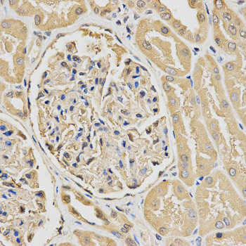HUS1 Antibody - Immunohistochemistry of paraffin-embedded human kidney tissue.