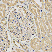 HUS1 Antibody - Immunohistochemistry of paraffin-embedded human kidney tissue.