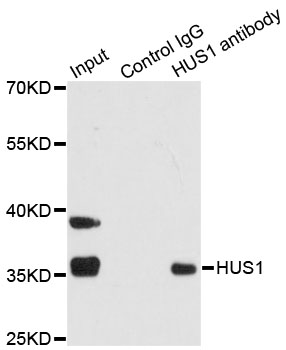 HUS1 Antibody - Immunoprecipitation analysis of 200ug extracts of 293T cells.