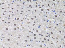 HUS1 Antibody - Immunohistochemistry of paraffin-embedded rat liver using HUS1 antibody at dilution of 1:100 (40x lens).
