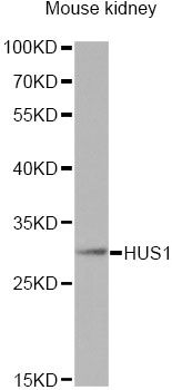 HUS1 Antibody - Western blot analysis of extracts of mouse kidney, using HUS1 antibody at 1:1000 dilution. The secondary antibody used was an HRP Goat Anti-Rabbit IgG (H+L) at 1:10000 dilution. Lysates were loaded 25ug per lane and 3% nonfat dry milk in TBST was used for blocking. An ECL Kit was used for detection and the exposure time was 180s.