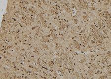 HUS1B Antibody - 1:100 staining rat brain tissue by IHC-P. The sample was formaldehyde fixed and a heat mediated antigen retrieval step in citrate buffer was performed. The sample was then blocked and incubated with the antibody for 1.5 hours at 22°C. An HRP conjugated goat anti-rabbit antibody was used as the secondary.