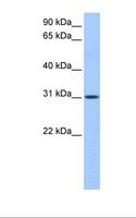 HUS1B Antibody - Liver cell lysate. Antibody concentration: 0.5 ug/ml. Gel concentration: 12%.  This image was taken for the unconjugated form of this product. Other forms have not been tested.