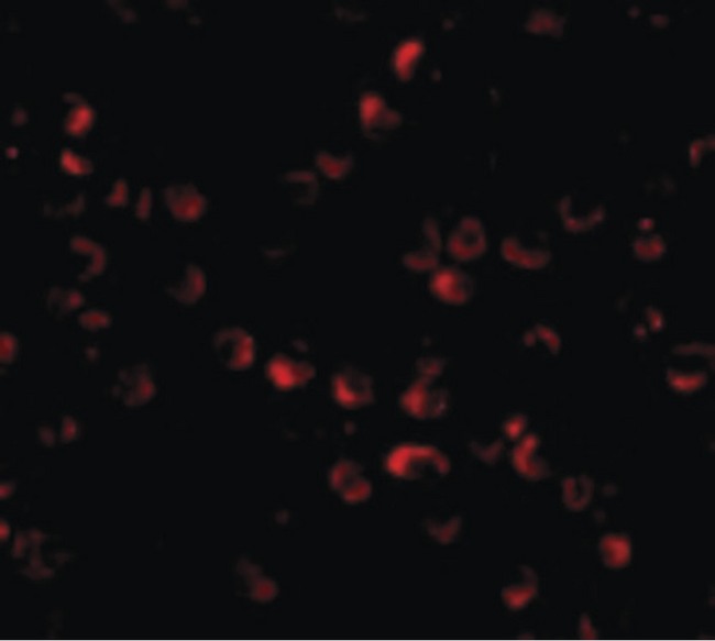 HUWE1 / ARFBP1 Antibody - Immunofluorescence of ARF-BP1 in Daudi cells with ARF-BP1 antibody at 20 ug/ml.
