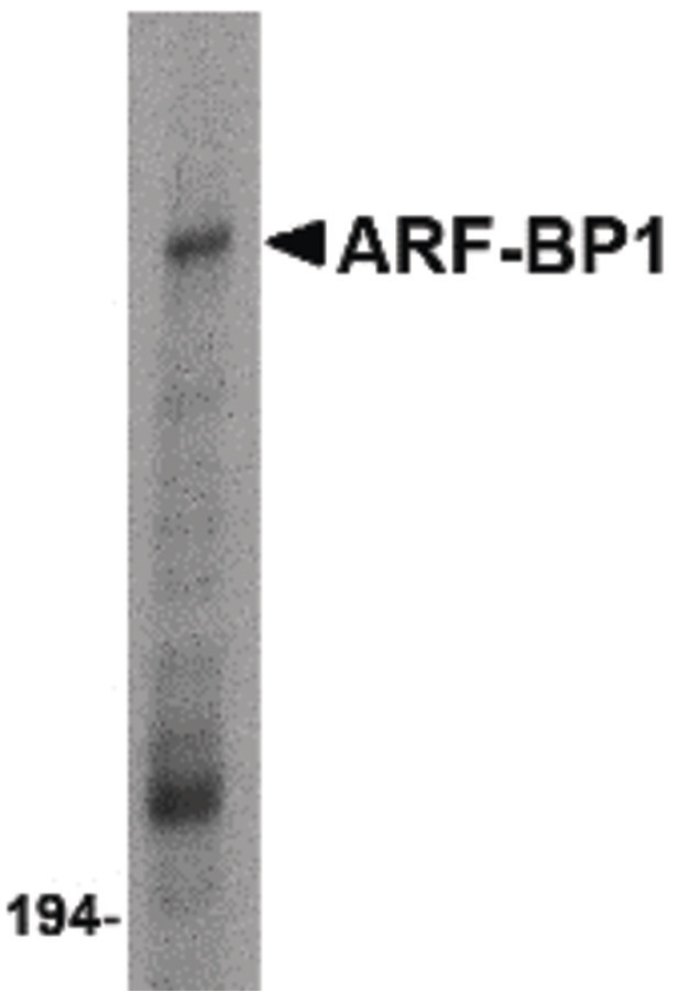 HUWE1 / ARFBP1 Antibody - Western blot of ARF-BP1 in Daudi cell lysate with ARF-BP1 antibody at 1 ug/ml.